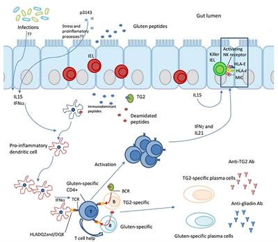 Intestinal Anti-tissue Transglutaminase2 Autoantibodies: Pathogenic and Clinical Implications for Celiac Disease